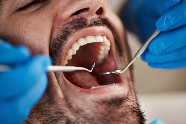 Best Emergency Treatment for Oral Infections in Wellsville, UT